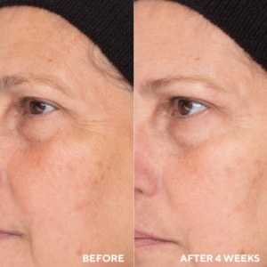 Retinol Routine Booster - Image 3
